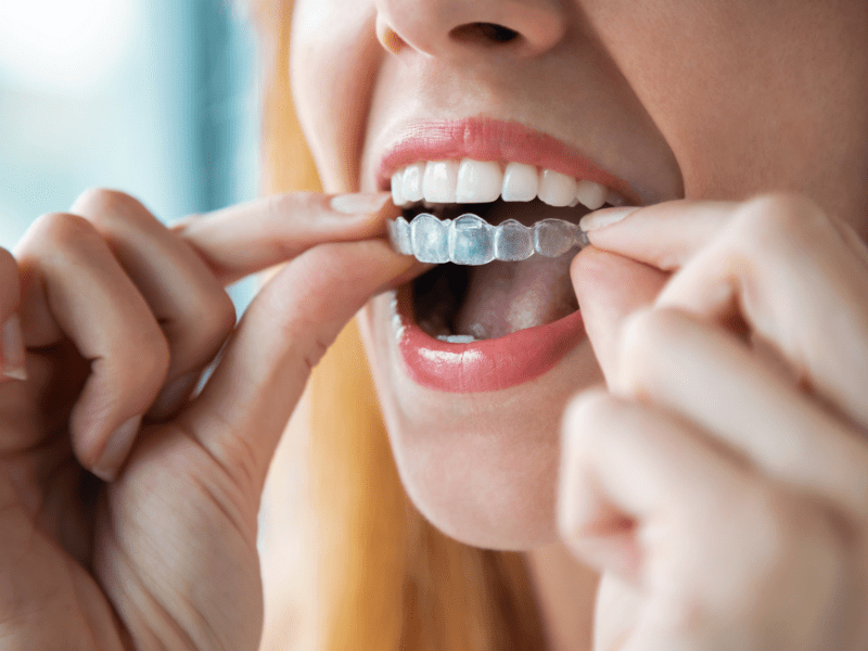 Dentista en Sevilla Dentalpasca